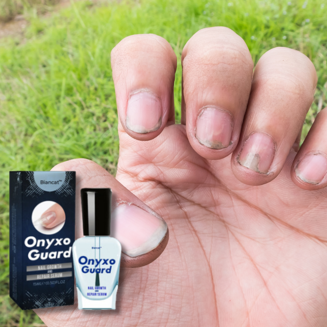 ONYXOGUARD ®️ 💅(2x1)