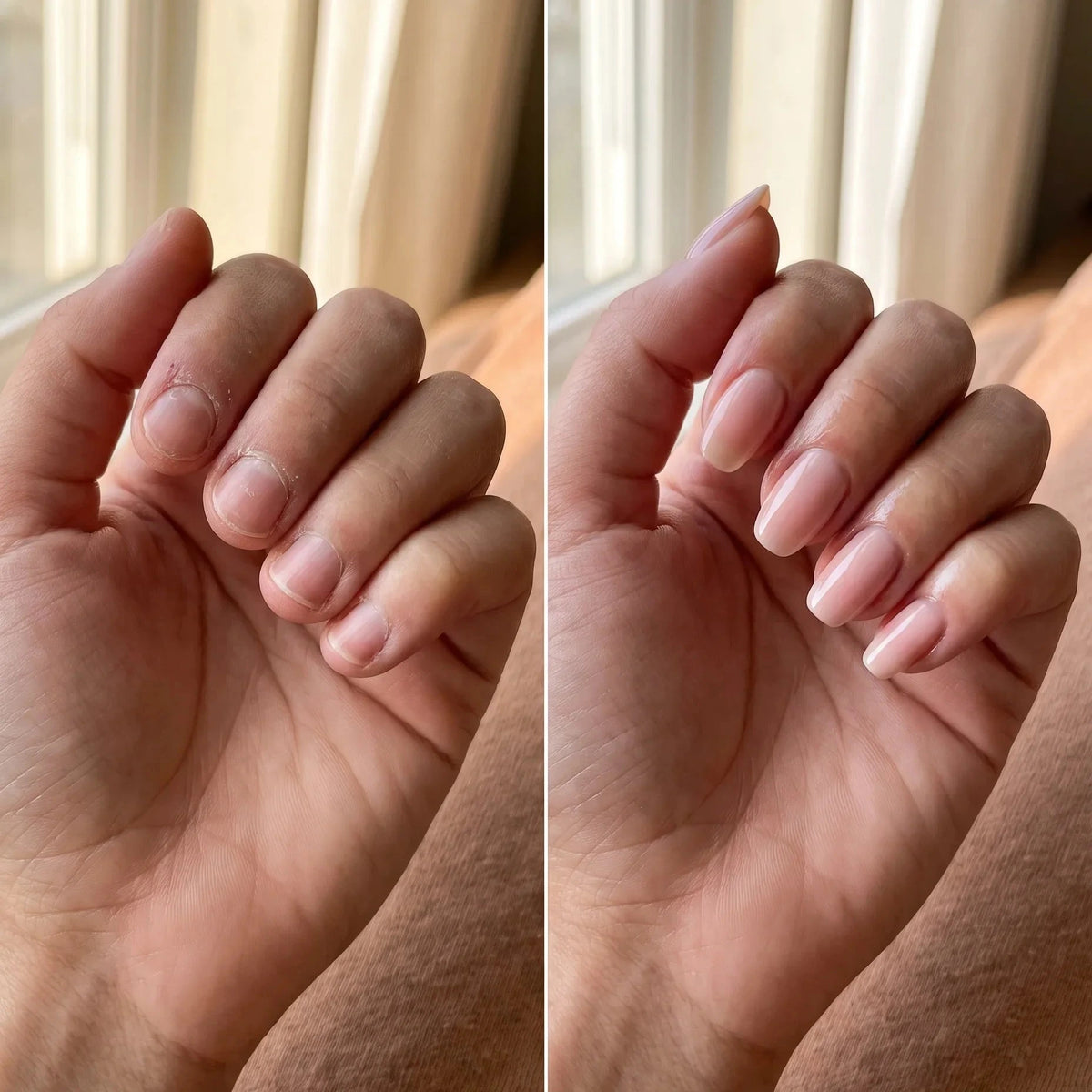 Antes y después uñas NailGinger