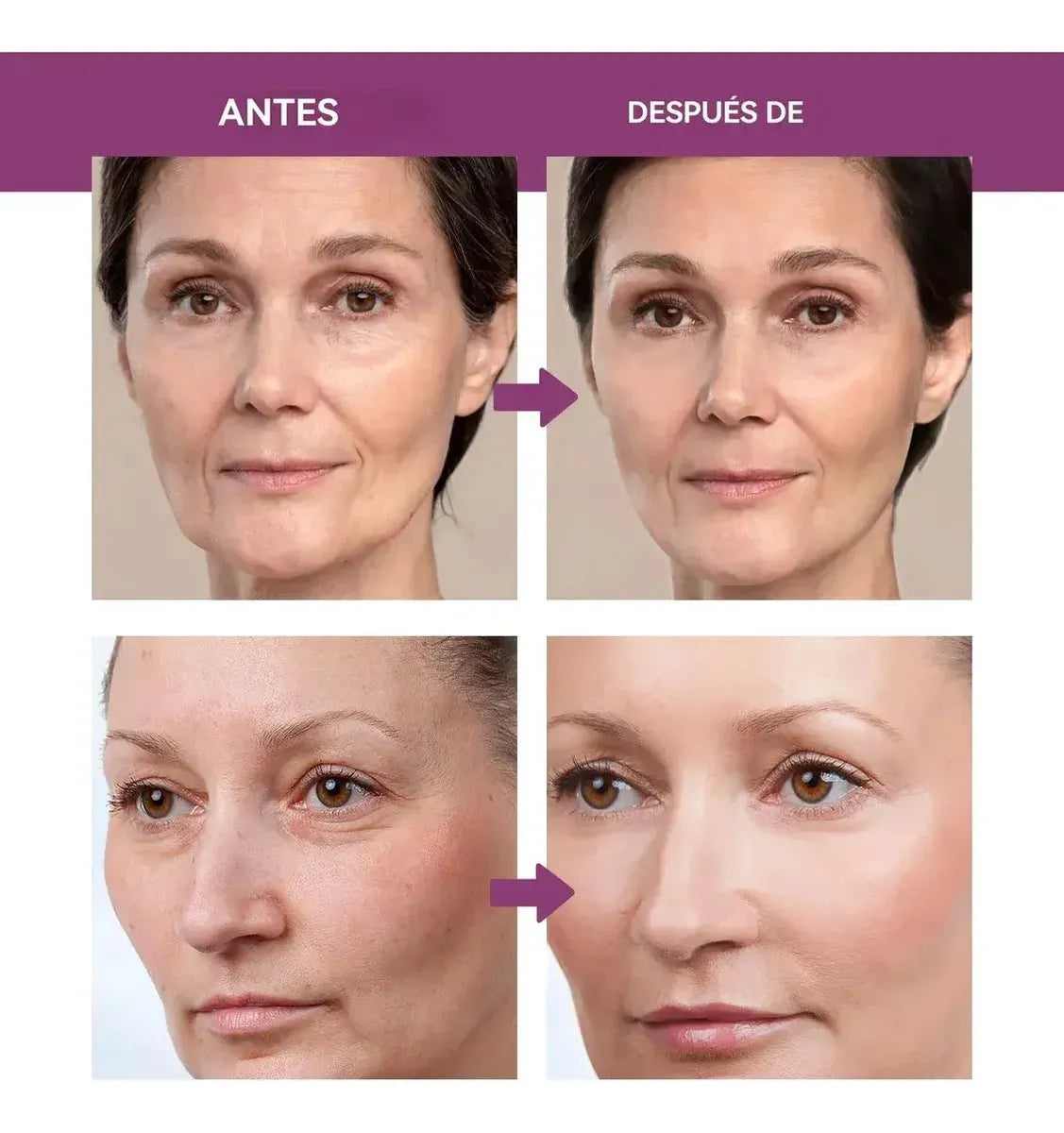 Kit Adiós Arrugas 🌙✨ Cara, Ojos, Labios y Cuello en Una Sola Barra