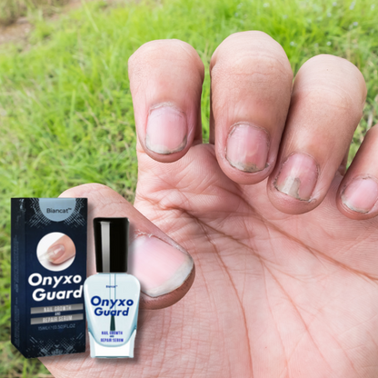 ONYXOGUARD ®️ 💅(2x1)