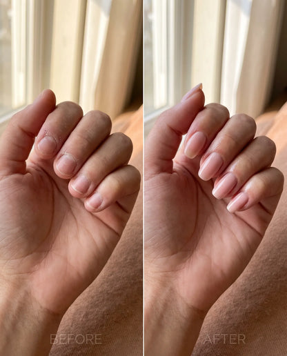 Antes y después uñas NailGinger